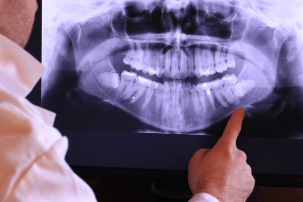 Best Emergency Treatment for Dental Infections or Abscesses in Watchung, NJ
